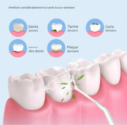 Nettoyeur dentaire à eau portable